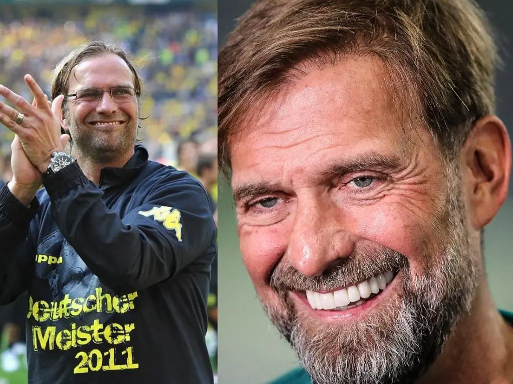 Jurgen Klopp before and after pictures